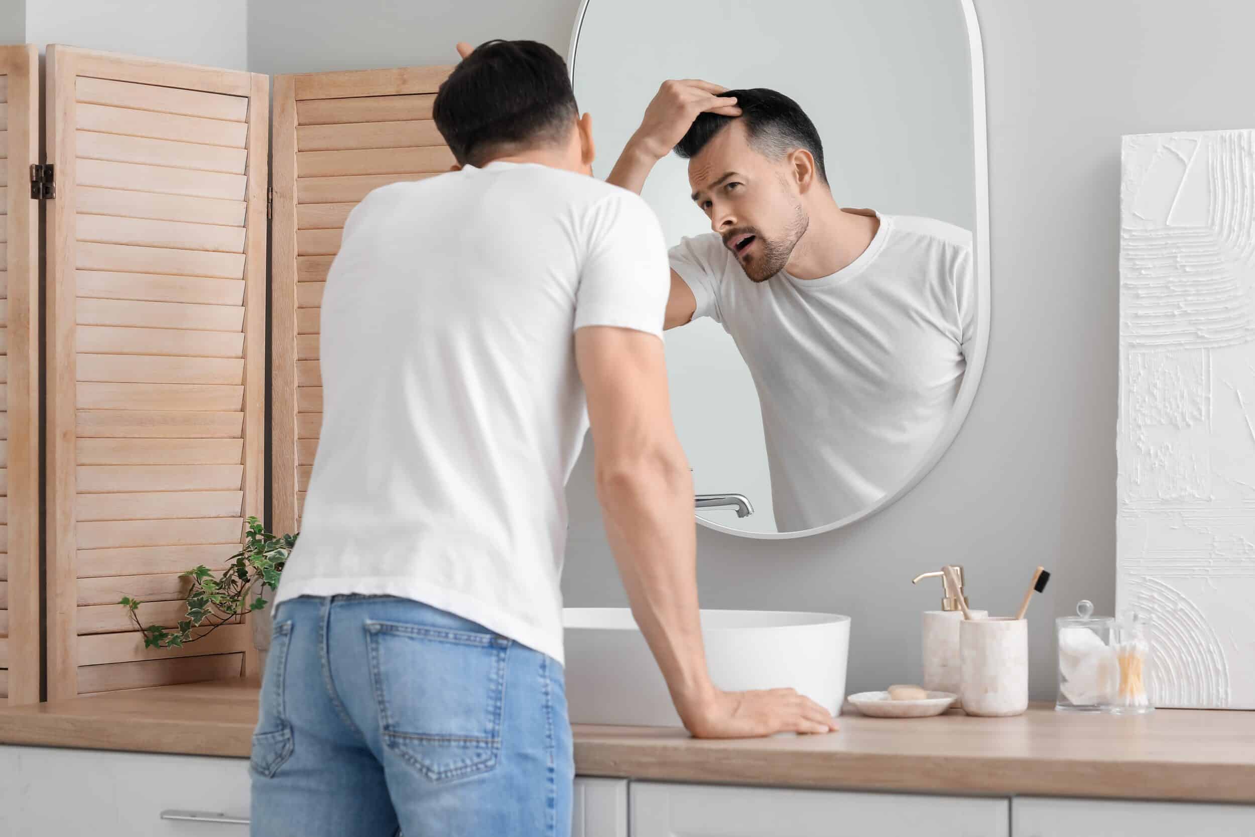 Worried,Young,Man,With,Hair,Loss,Problem,Looking,In,Mirror